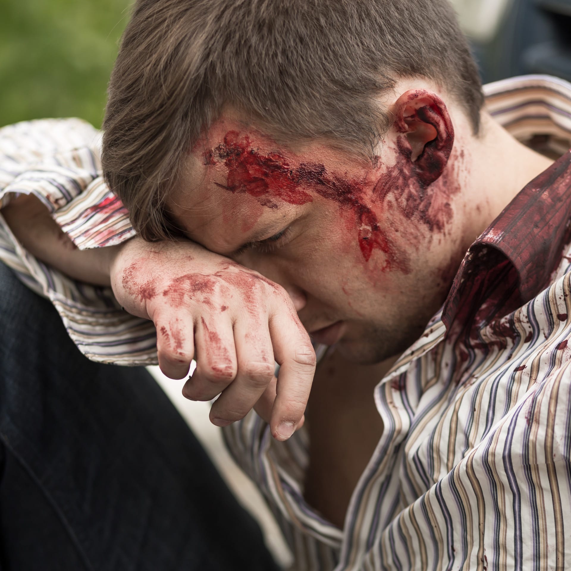 young-injured-bloody-man-after-car-crash-John-FRANCEY